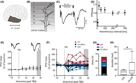 Longterm Potentiation Of Synaptic Plasticity Is Disrupted In Temporal