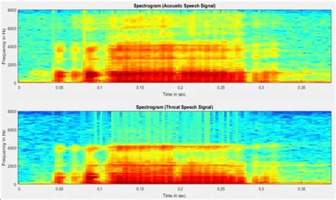 Spectrograms Of Speech Sound For Vowel A Recorded Simultaneously By Download Scientific