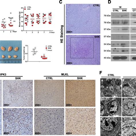 Shikonin Inhibits The Growth Of Tki Resistant Cml Cells In Vivo A