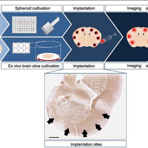 Organotypic Brain Slice Cultures Maintain Characteristic Features Of