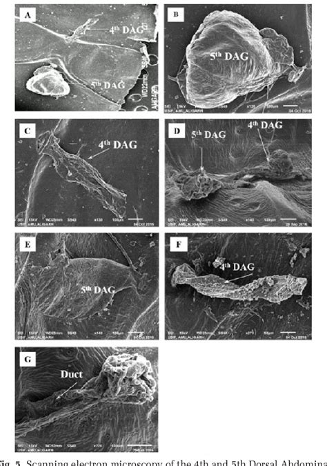 Figure 5 From Pheromone Producing Dorsal Abdominal Glands In Leptocoris Augur Semantic Scholar