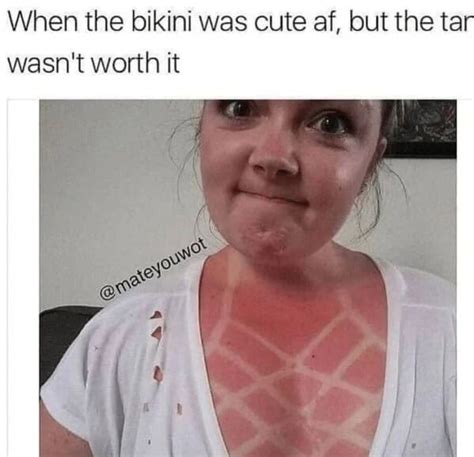 35 Funny Sunburn Memes That'll Have You Reaching For The Sunscreen ...