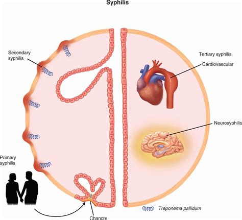 37 Spirochetes | Basicmedical Key