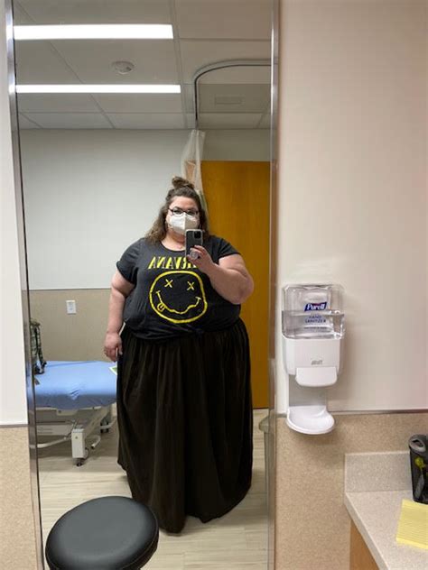 My Journey Thus Far With Lipedema And Lymphedema Finding Evie