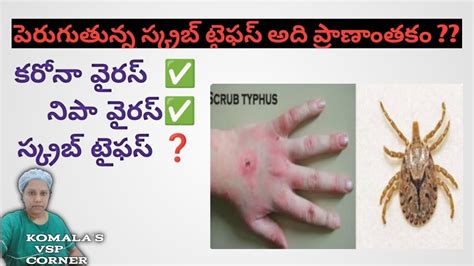 Scrub Typhus New Deadly Insect Bitten Disease YouTube