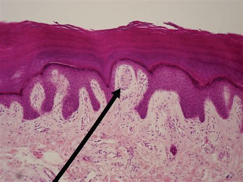 Protection and Sensory Function | Biology for Majors II