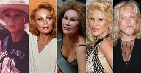 Murió Jocelyne Wildenstein conocida como Catwoman por sus múltiples