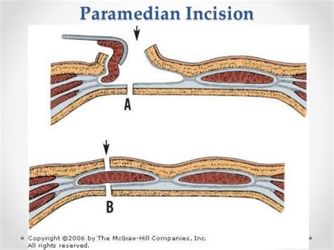 Surgical Anatomy Of Anterior Abdominal Wall