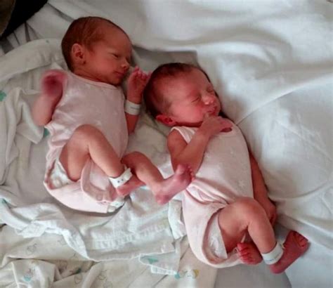 Twins Born At 362 Weeks My Twin Birth Story Twinfo