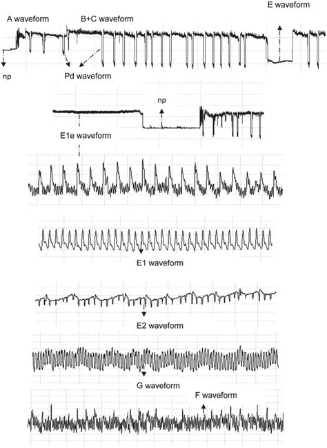 Effects Of Solenopsis Invicta Hymenoptera Formicidae Tending On The