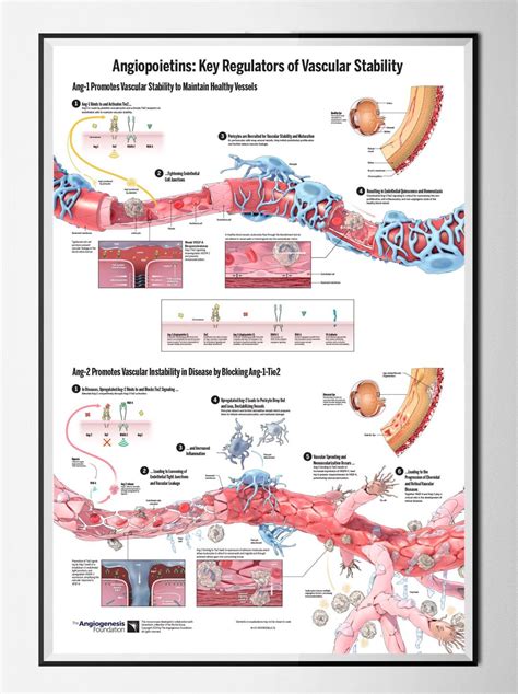 Wall Charts And Postersthe Angiogenesis Foundation