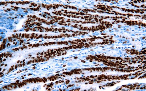 Ki Rabbit Monoclonal Antibody Mab Ihc P Buy Now Abcepta