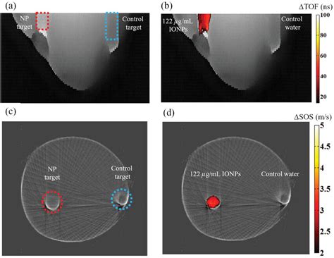 Breast Phantom Imaging A Baseline Tof Projection Image The Left