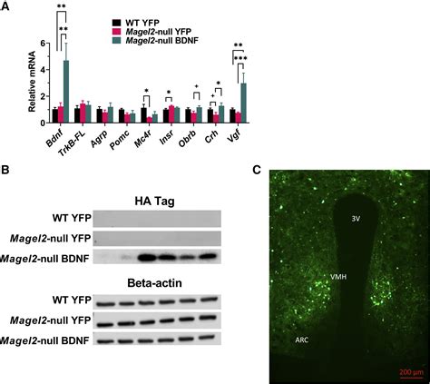 Hypothalamic Aav Bdnf Gene Therapy Improves Metabolic Function And