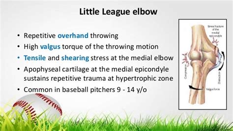 Little League Elbow