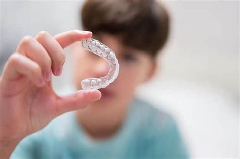 Everything You Need To Know About Suresmile Clear Aligners