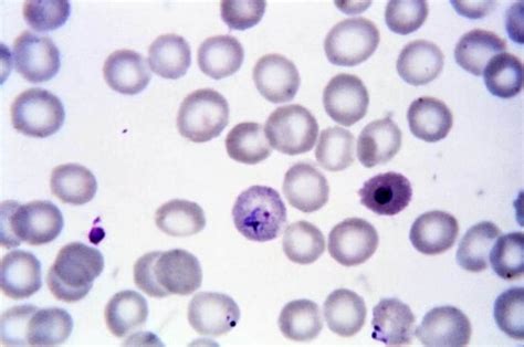 Free Picture Micrograph Ring Form Plasmodium Falciparum Trophozoites