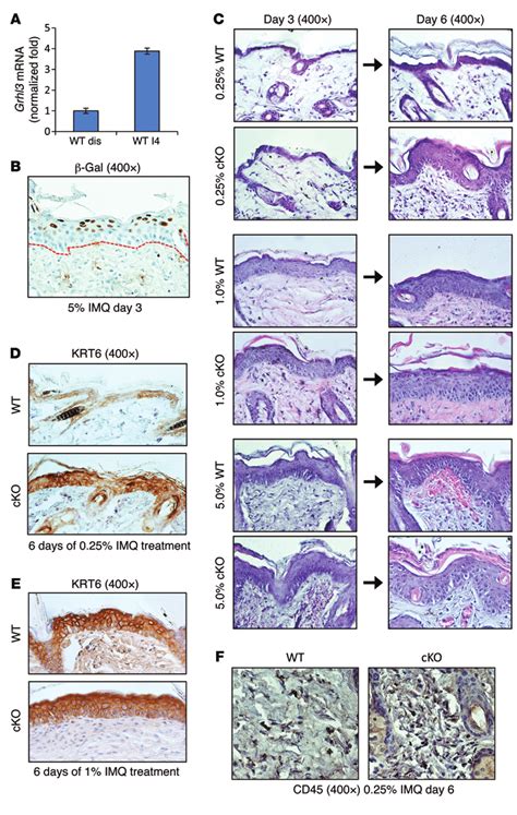 Loss Of Grhl3 Increases Susceptibility To Immune Mediated Epidermal Download Scientific Diagram