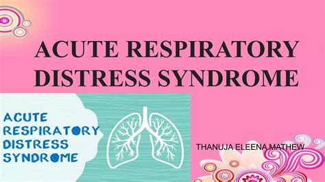 Acute Respiratory Distress Syndrome Ppt