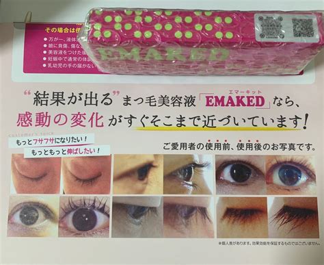 メーカー公式ショップ エマーキット Emakedエマーキッド 2ml 3本セット Nikko Bsakuranejp