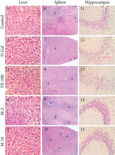 Effect Of Mat On Liver Spleen And Brain Histopathological Download Scientific Diagram