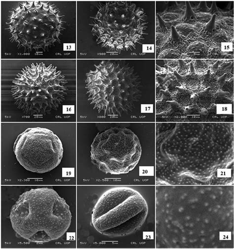 Fig Ure 7 Scanning Electron Microscope Photomicrographs Of Download Scientific Diagram