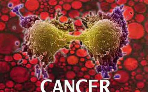 Cancer to be A Major Disease in India: Change in Lifestyle Main Culprit