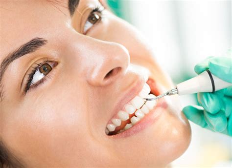 Os benefícios de uma boa limpeza dental