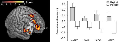 Oxytocin Effects On Neuronal Activity During Food Picture Presentation