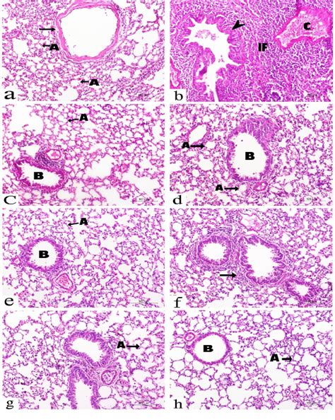 Representative Photomicrograph Depicts Histopathological Changes In