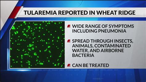 St Human Case Of Tularemia In Wheat Ridge Resident Youtube