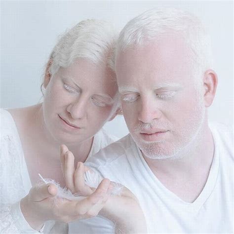 20 Stunning Portraits Showing Albinism S Beauty