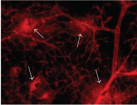 Effects Of UPARANT On Evans Blue Leakage Ad Blood Retinal Vascular