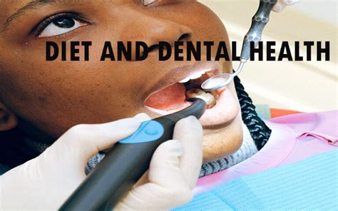 Diet And Dental Health