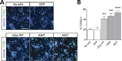 Cytotoxicity Of A Synuclein Over Expression In Terminally