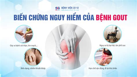 Biến chứng nguy hiểm của bệnh Gout Bệnh viện 22 12 VK Hospital