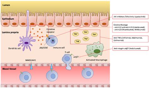 Therapeutic Management of Adults with Inflammatory Bowel Disease and