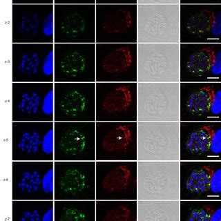 Fig S Tggra Tubules Are Localized Inside The Pv Different Z Stack