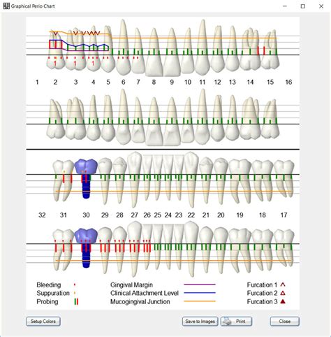 Dental and Perio Charts