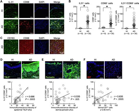 IL 31generating Network In Atopic Dermatitis Comprising Macrophages