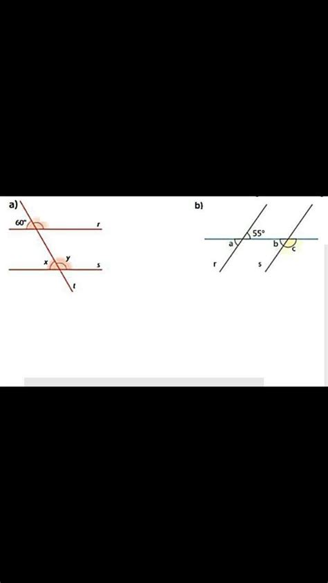 Observe As Retas R E S Sendo R S Determine As Medidas Dos Ngulos
