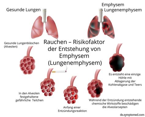 Lungenemphysem Symptome