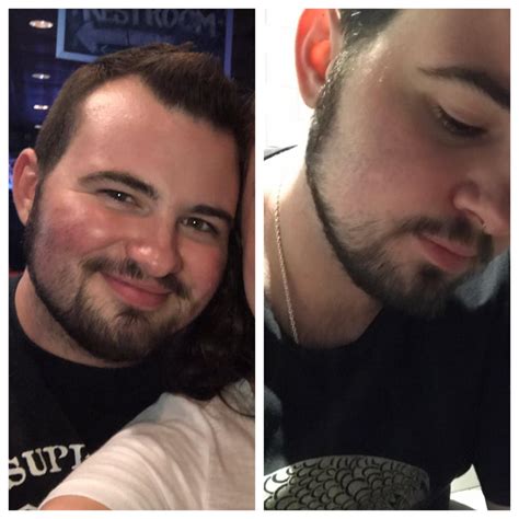 Validate This Beard Ftm 3 Years On T Lgbt