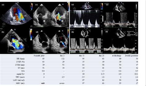 Transthoracic echocardiogram (TTE) changes. The chart shows the... | Download Scientific Diagram