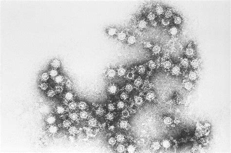 Coxsackie Virus Wikipedia