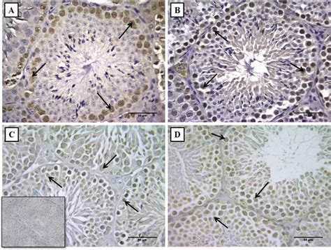 Photomicrograph Of Immunohistochemistry For Proliferating Cell