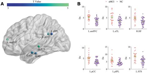 Increased Intrinsic Default Mode Network Activity As A Compensatory