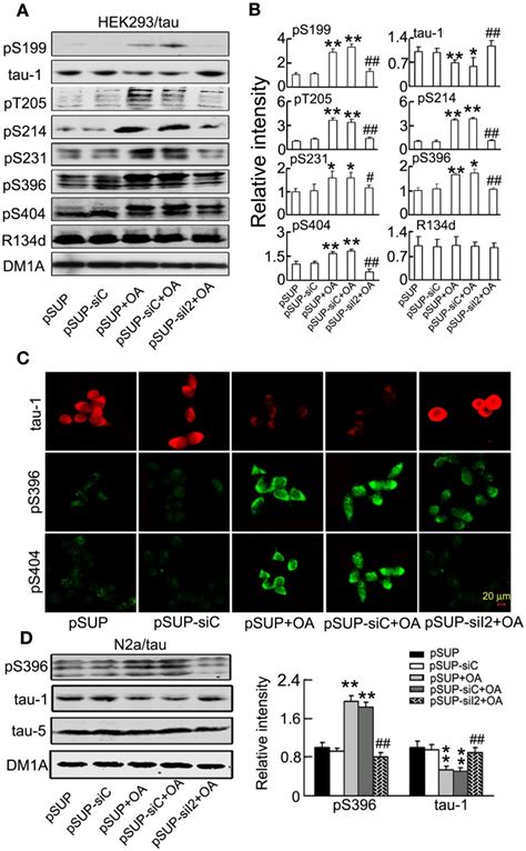 Inline Formula Attenuates Tau Hyperphosphorylation Induced By