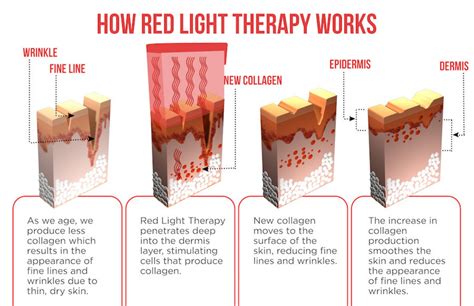 Benefits Of Red Infrared Light Therapy Devices Lukirch®