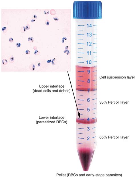 Percoll density gradient centrifugation procedure